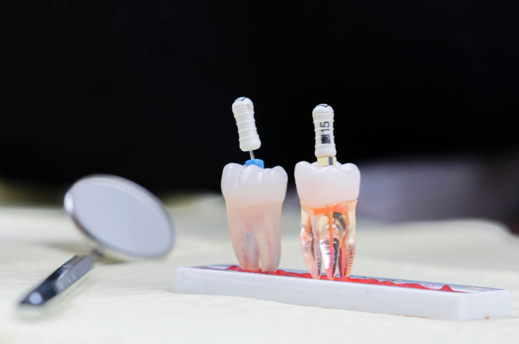 Micro-Endodontics